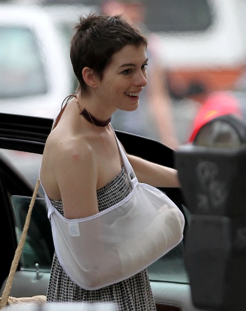 Fantine broke her arm