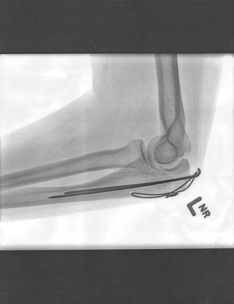 The Essence of Mischa Barton…