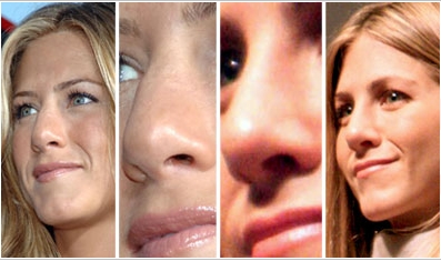 A Deviated Septum requires shaving?