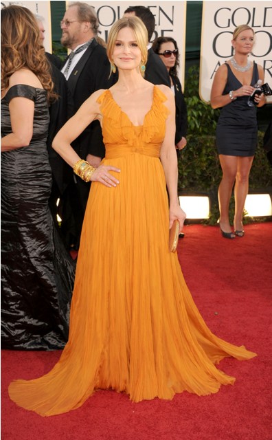 Best Globe Colour: Kyra Sedgwick