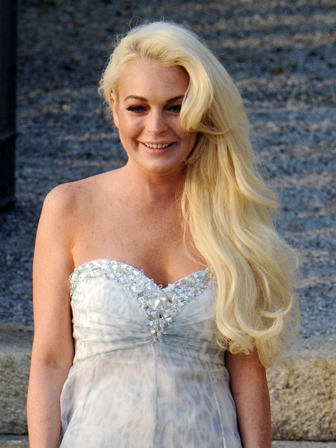 The model with yellow teeth