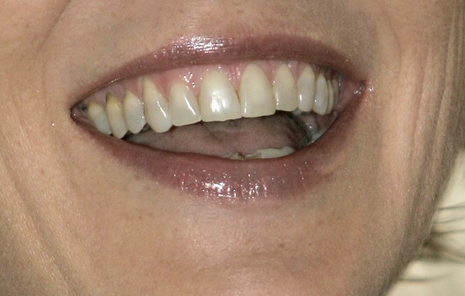 Smutty Sponsor: SoftLips Giveaway #9