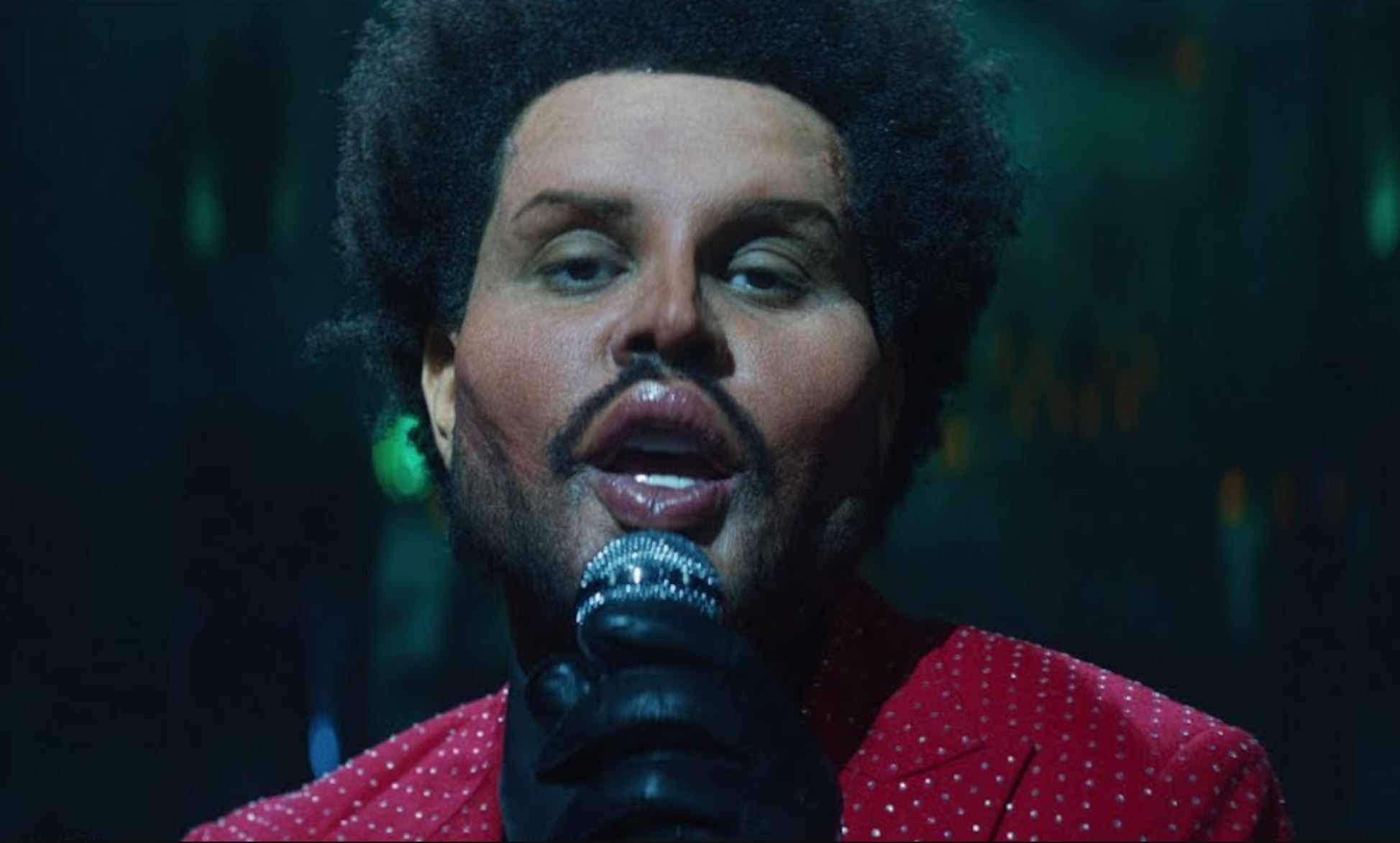 The Weeknd’s Had Work done